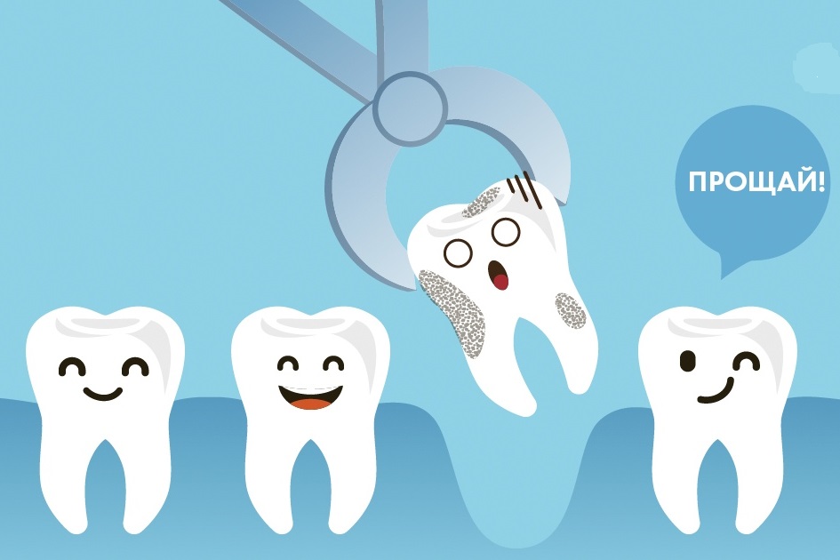 5 причин, когда стоматологи рекомендуют удалять молочные зубы